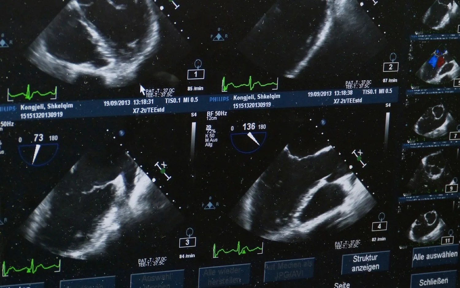 Diagramme d'un réseau DICOM pour la recherche d'imagerie médicale